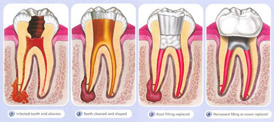 best dental implant clinic in bannerghatta road