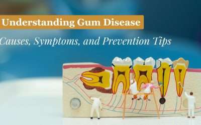 Understanding Gum Disease: Causes, Symptoms, and Prevention Tips