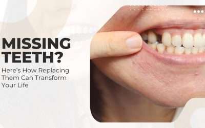 Missing Teeth? Here’s How Replacing Them Can Transform Your Life