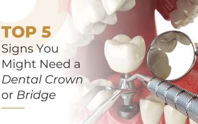 Top 5 Signs You Might Need a Dental Crown or Bridge