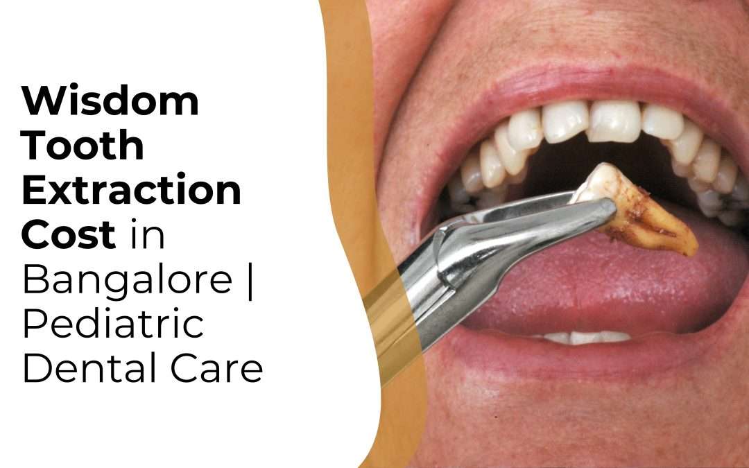 Wisdom Tooth Extraction Cost in Bangalore | Pediatric Dental Care