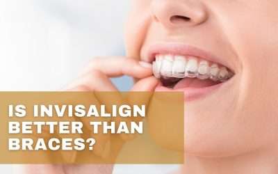 Is Invisalign Better Than Braces?
