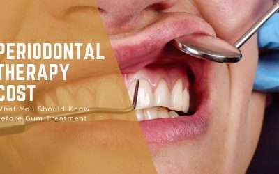 Periodontal Therapy Cost: What You Should Know Before Gum Treatment