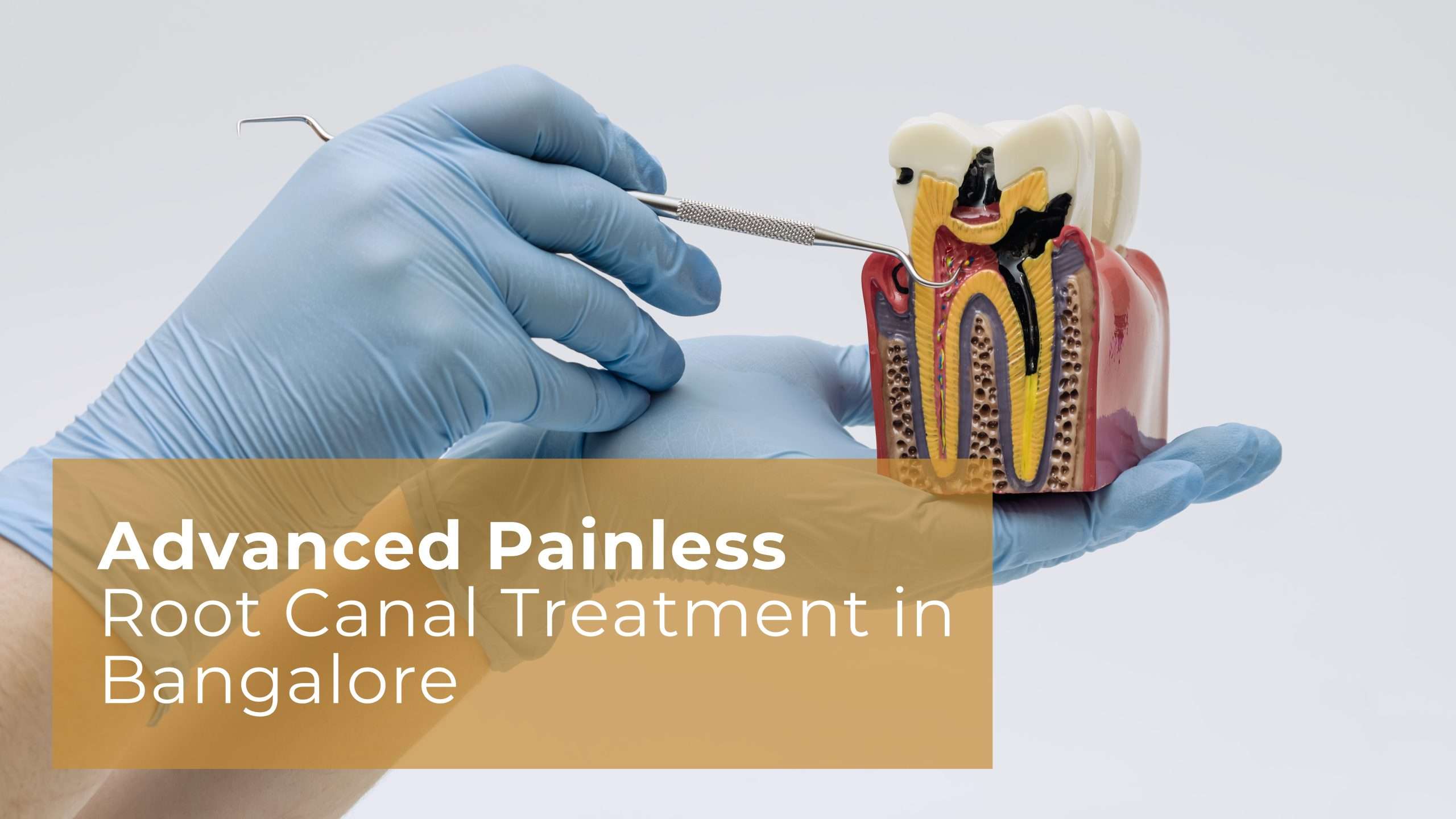 Advanced Painless Root Canal Treatment in Bangalore