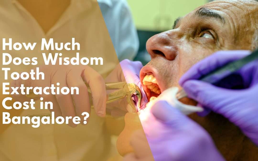 How Much Does Wisdom Tooth Extraction Cost in Bangalore?