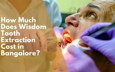 How Much Does Wisdom Tooth Extraction Cost in Bangalore?