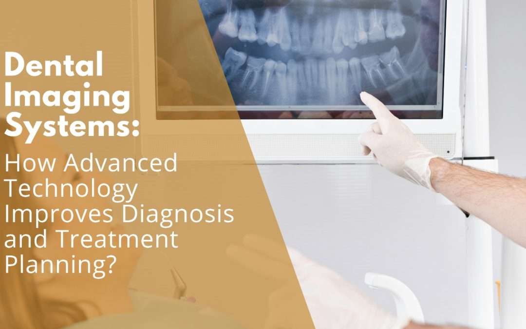 Dental Imaging Systems: How Advanced Technology Improves Diagnosis and Treatment Planning?