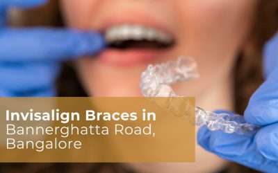 Invisalign Braces in Bannerghatta Road, Bangalore