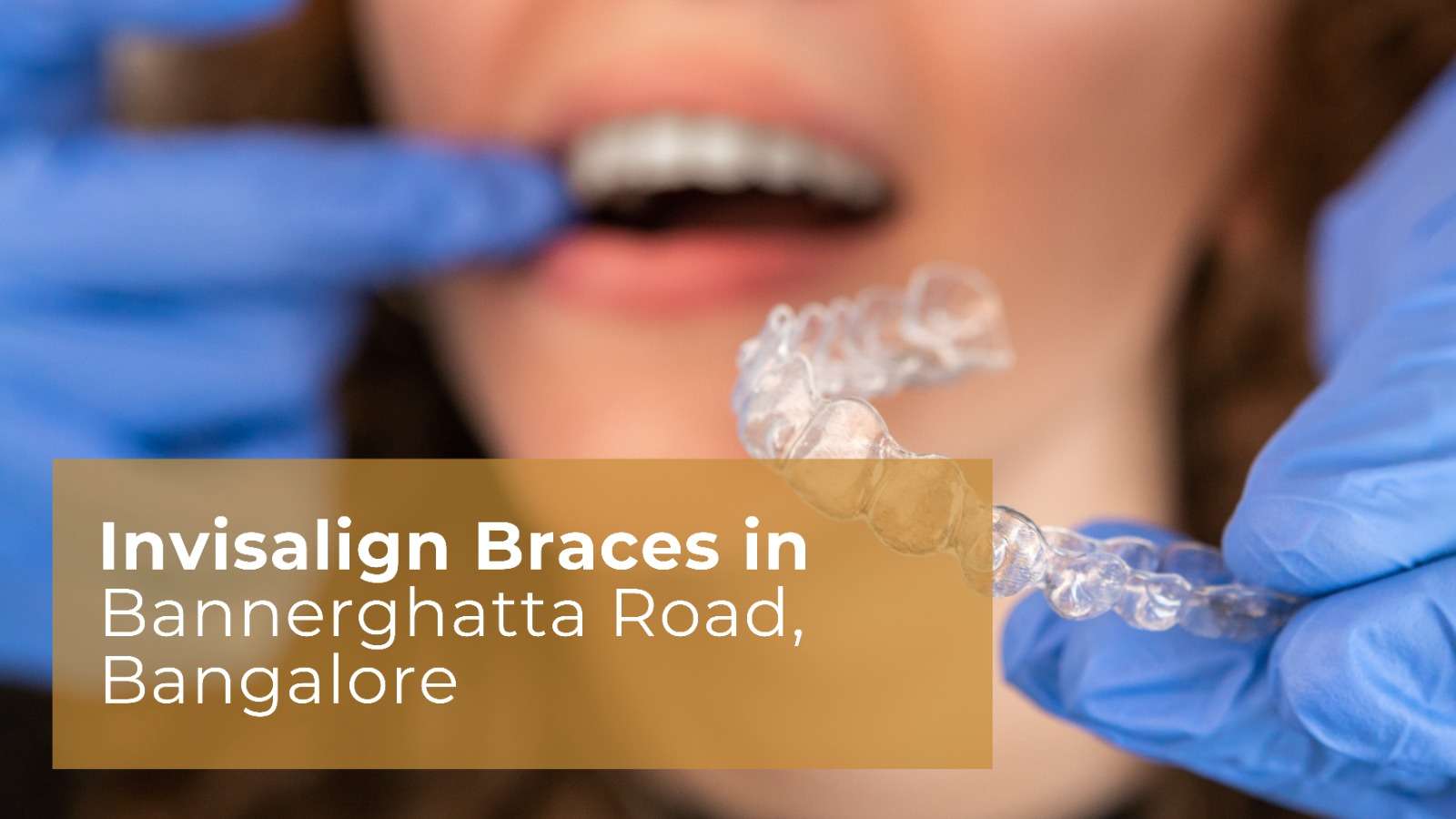 Invisalign Braces in Bannerghatta Road, Bangalore Invisalign Braces in Bannerghatta Road, Bangalore