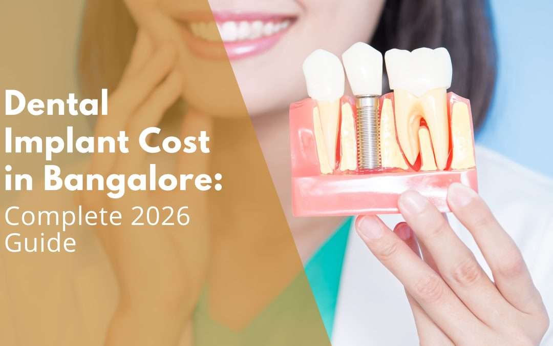Dental Implant Cost in Bangalore: Complete 2026 Guide