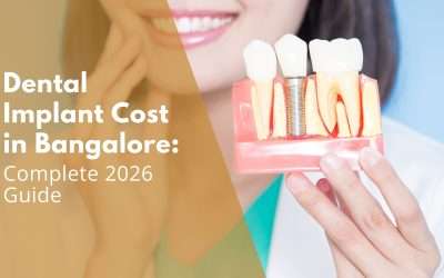 Dental Implant Cost in Bangalore: Complete 2026 Guide