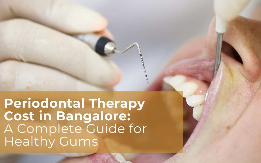 Periodontal Therapy Cost in Bangalore: A Complete Guide for Healthy Gums