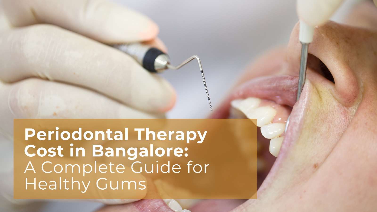 Periodontal Therapy Cost in Bangalore: A Complete Guide for Healthy Gums