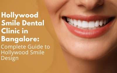 Hollywood Smile Dental Clinic in Bangalore: Complete Guide to Hollywood Smile Design