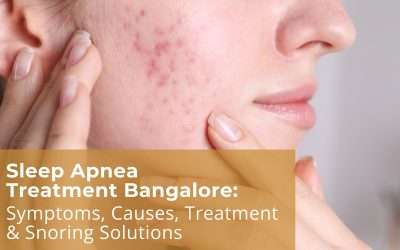 Sleep Apnea Treatment Bangalore: Symptoms, Causes, Treatment & Snoring Solutions
