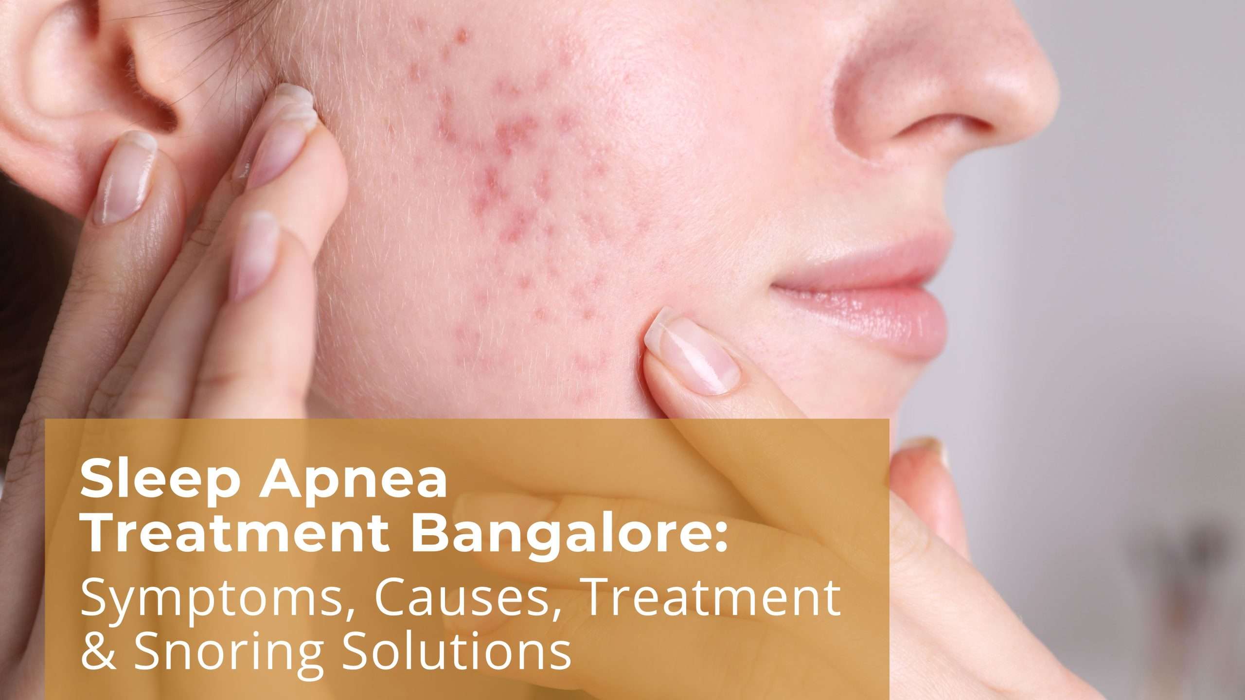 Sleep Apnea Treatment Bangalore: Symptoms, Causes, Treatment & Snoring Solutions